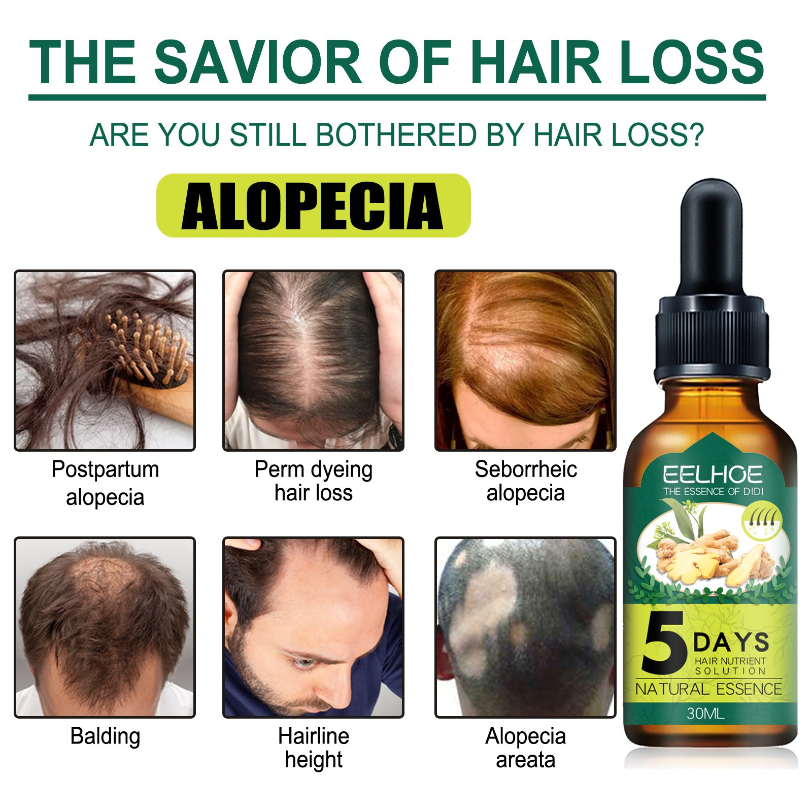 EELHOE Ginger Hair Essential Oil – Nourishing Hair Growth Scalp Care
