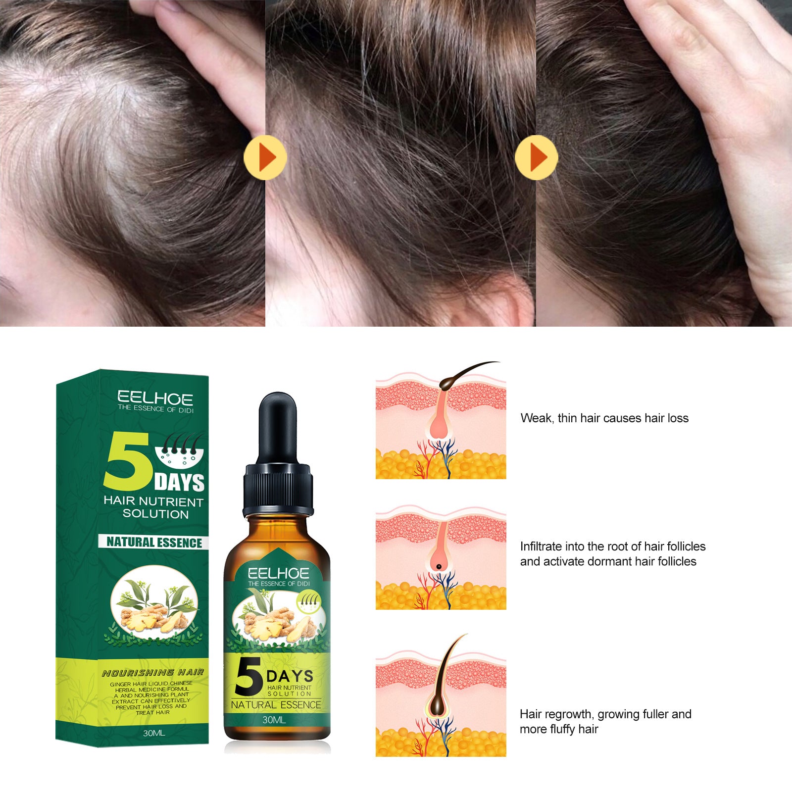 EELHOE Ginger Hair Essential Oil – Nourishing Hair Growth Scalp Care