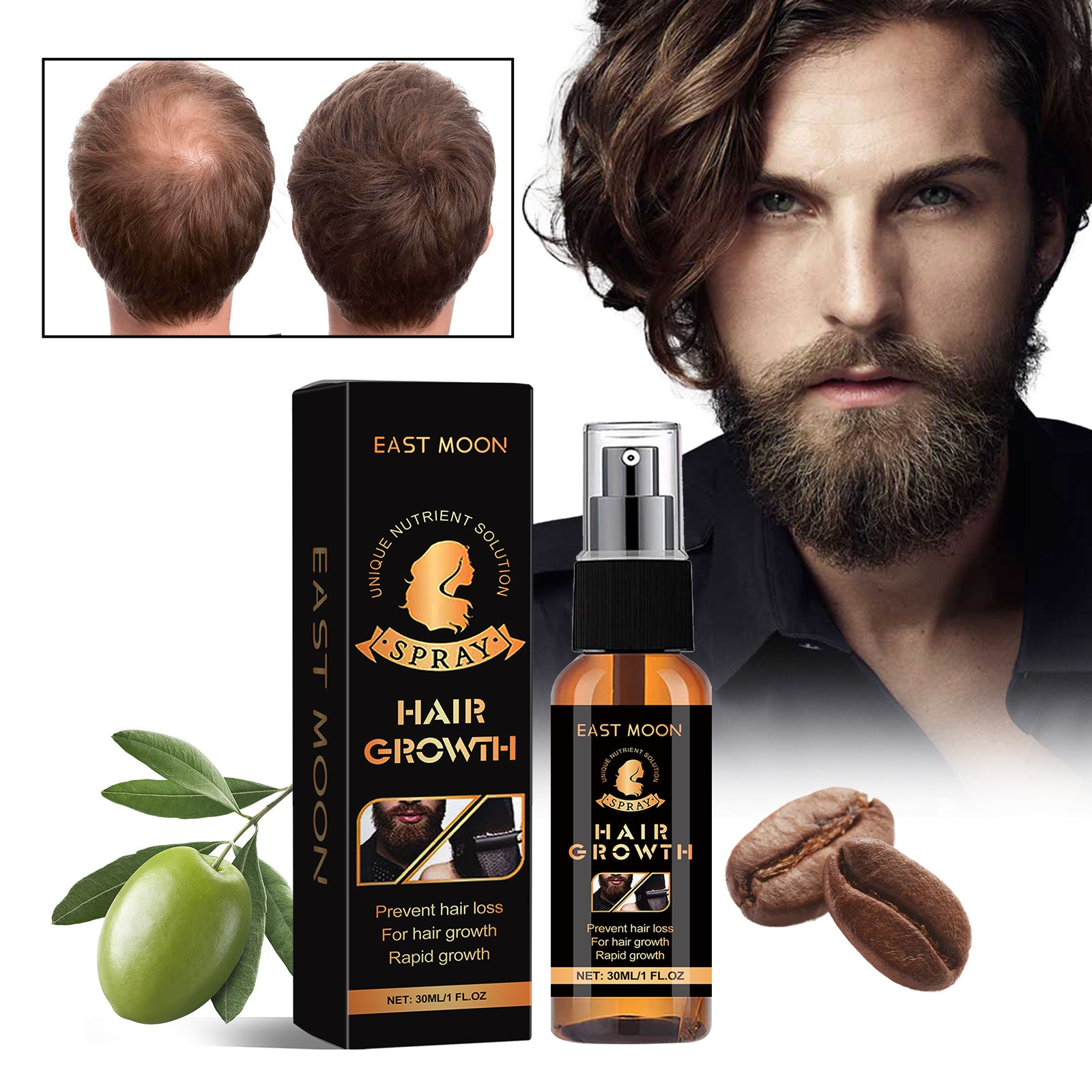 EAST MOON Hair Growth Spray – Oil Control & Scalp Moisturizing Treatment
