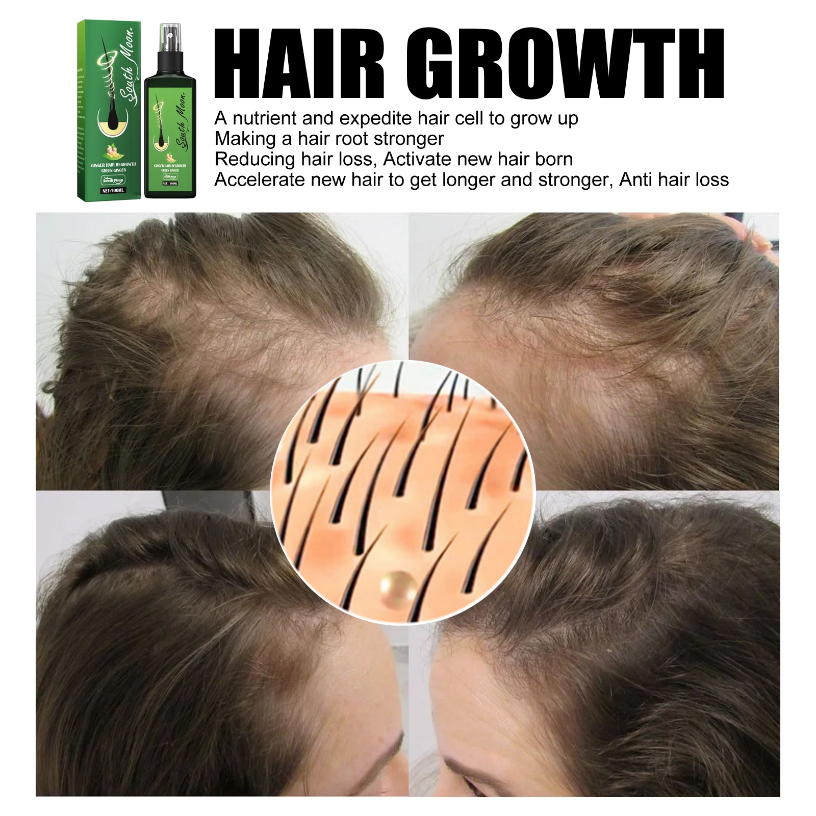 South Moon Hair Growth Spray – Strengthening Anti Hair Fall Scalp Care