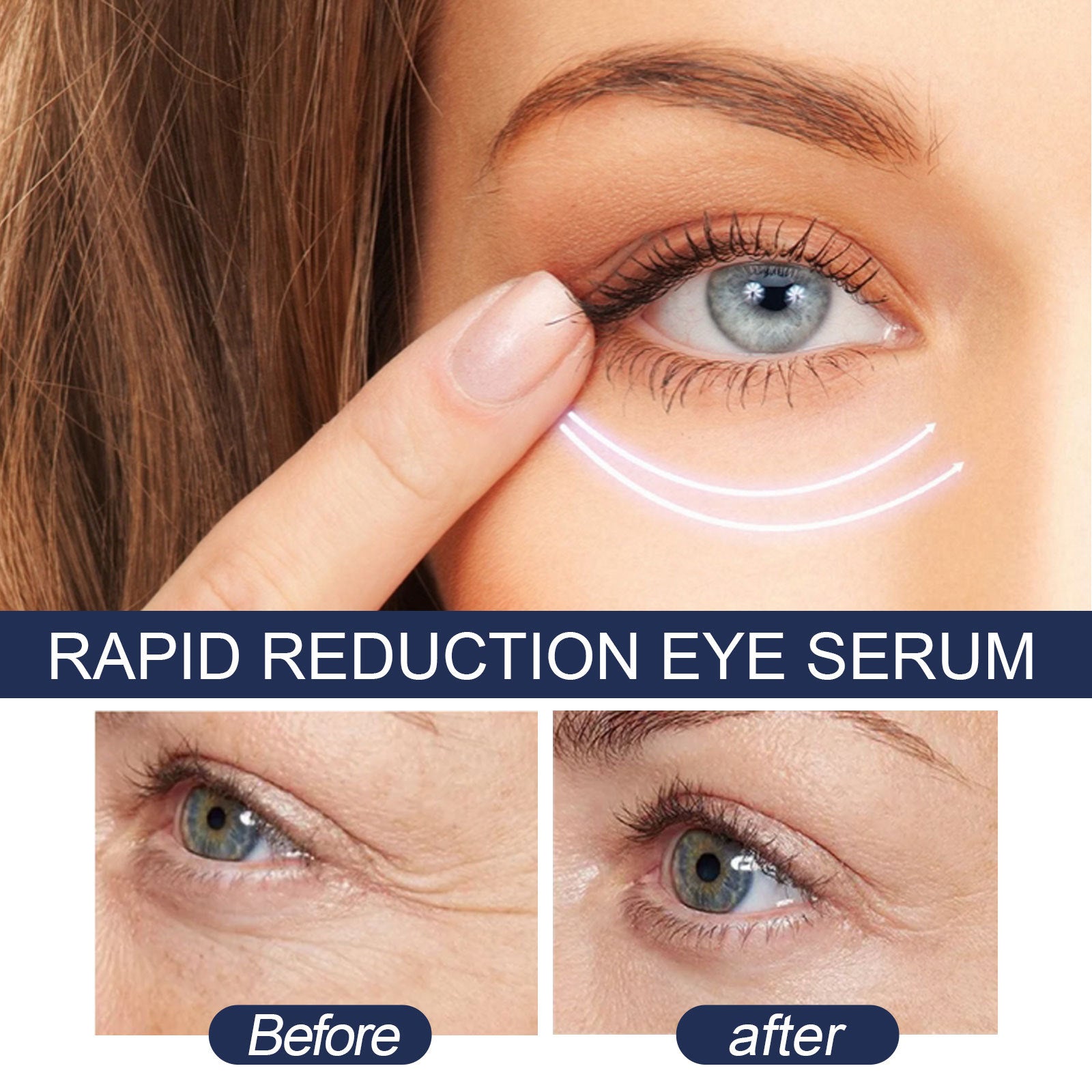 EELHOE Eye Repair Serum – Hydrating Firming Eye Cream for Fine Lines